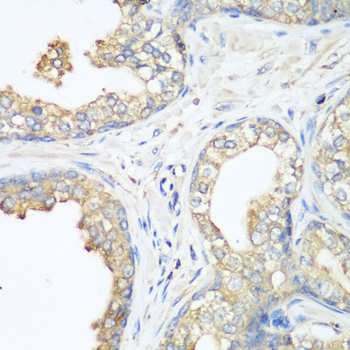 CBL Polyclonal Antibody (E-AB-63260)