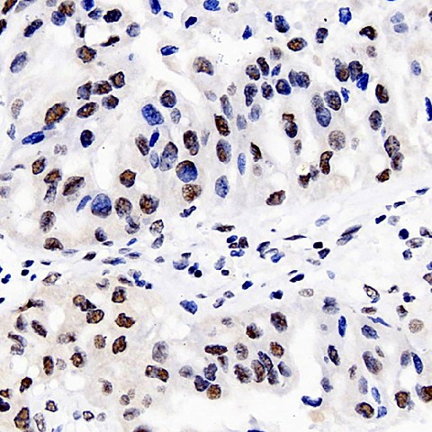DNMT1 Polyclonal Antibody (E-AB-70196)