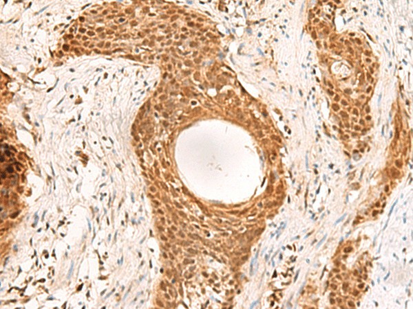 RMND5B Polyclonal Antibody (E-AB-52625)