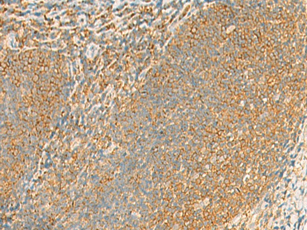 GRIA4 Polyclonal Antibody (E-AB-52035)