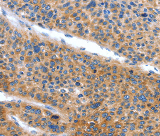 ARL11 Polyclonal Antibody (E-AB-14769)