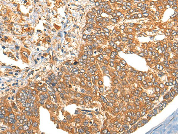 UBIAD1 Polyclonal Antibody (E-AB-17838)
