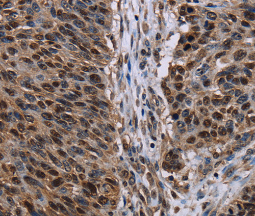 KDM3B Polyclonal Antibody (E-AB-15146)