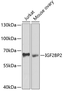 IGF2BP2 Polyclonal Antibody (E-AB-62357)
