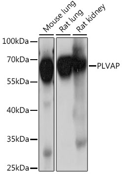 PLVAP Polyclonal Antibody (E-AB-91341)