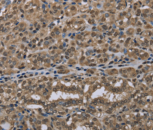 NLRP6 Polyclonal Antibody (E-AB-13438)