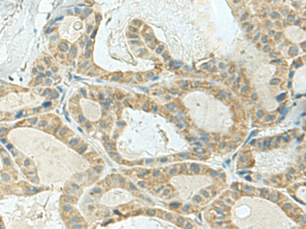 KLC2 Polyclonal Antibody (E-AB-19077)