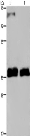 FETUB Polyclonal Antibody (E-AB-11229)