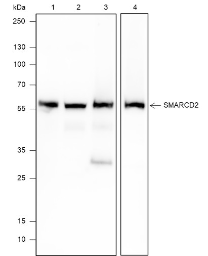 Recombinant SMARCD2 Monoclonal Antibody (AN301904L)