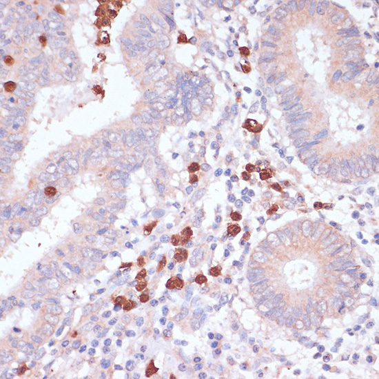 CD82 Polyclonal Antibody (E-AB-67224)