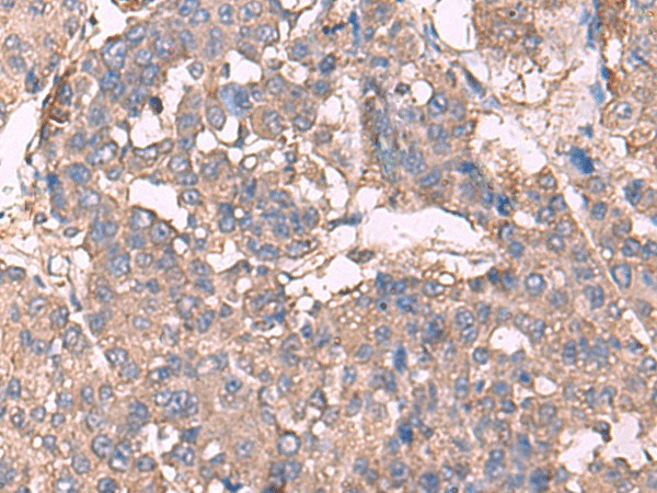 KCNN2 Polyclonal Antibody (E-AB-52083)