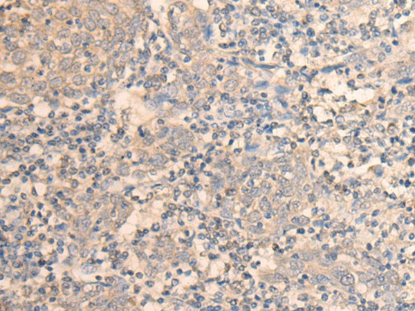 DAZ1 Polyclonal Antibody (E-AB-18643)