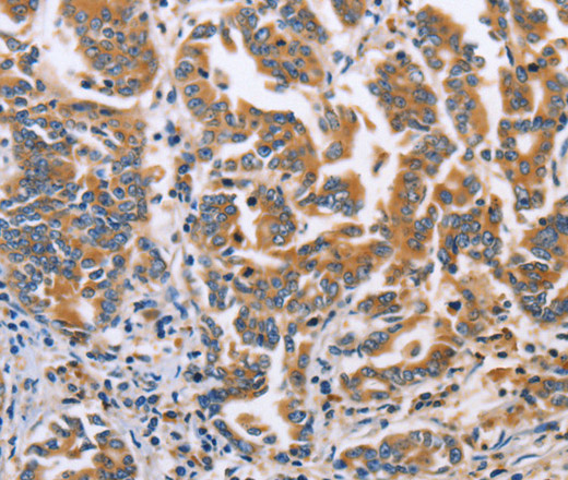 DOK4 Polyclonal Antibody (E-AB-14690)