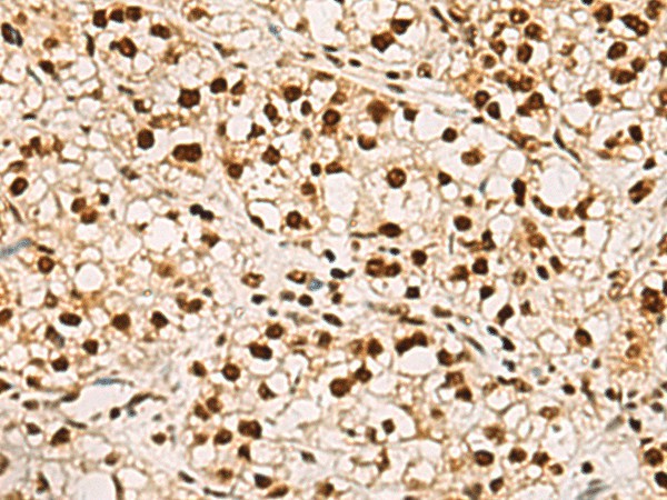 ELF5 Polyclonal Antibody (E-AB-53122)