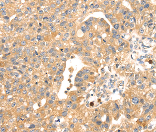 S100A12 Polyclonal Antibody (E-AB-11562)