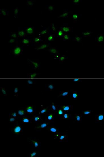 TRIM63 Polyclonal Antibody (E-AB-60840)