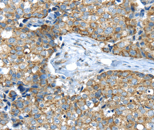 IFNA2 Polyclonal Antibody (E-AB-13320)