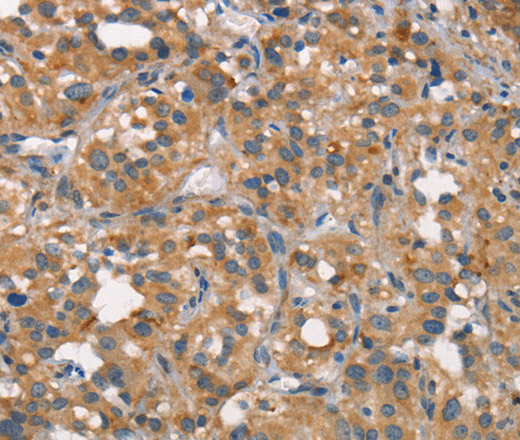 CEACAM6 Polyclonal Antibody (E-AB-12782)