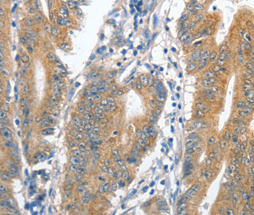 CENPC Polyclonal Antibody (E-AB-11073)