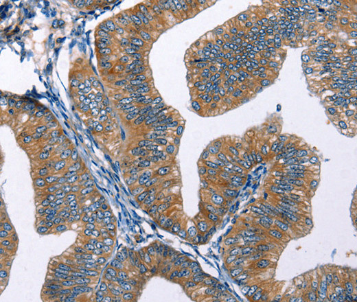 EDN2 Polyclonal Antibody (E-AB-10313)
