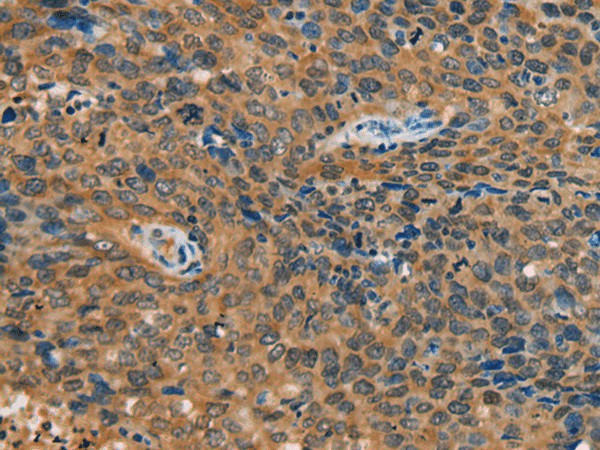 YTHDF1 Polyclonal Antibody (E-AB-53547)