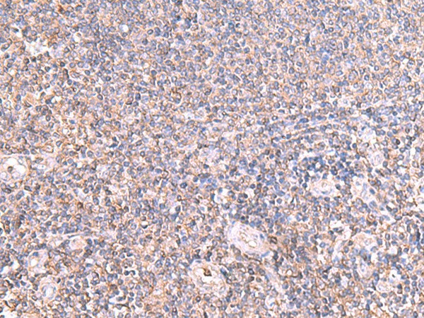 IFT57 Polyclonal Antibody (E-AB-19035)