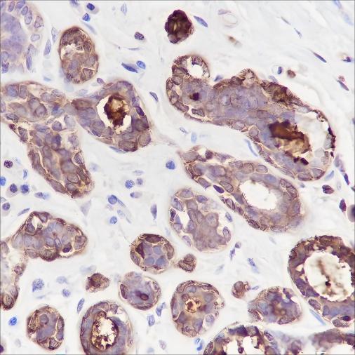 Recombinant GCDFP-15 Monoclonal Antibody (AN301529L)