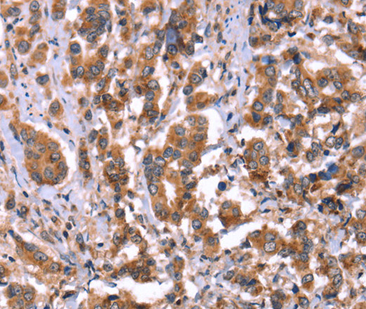 HRG Polyclonal Antibody (E-AB-13302)