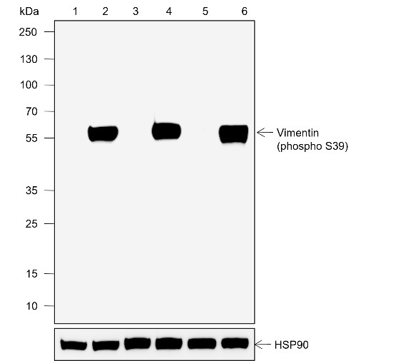 Recombinant Phospho-Vimentin (Ser39) Monoclonal Antibody (AN302096L)