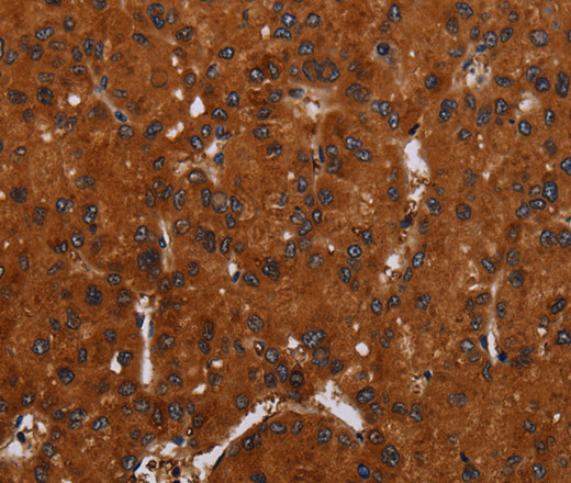 NOX3 Polyclonal Antibody (E-AB-16655)