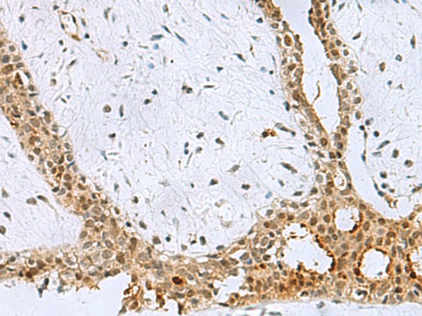 BCL7B Polyclonal Antibody (E-AB-53079)