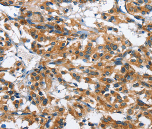 BPI Polyclonal Antibody (E-AB-14800)