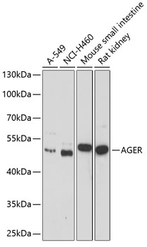 AGER Polyclonal Antibody (E-AB-60303)