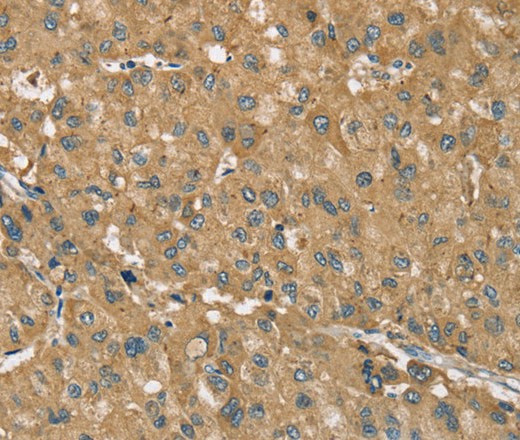 RNF148 Polyclonal Antibody (E-AB-16765)