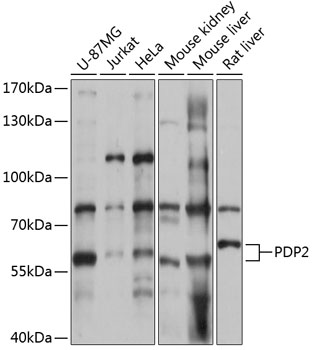 PDP2 Polyclonal Antibody (E-AB-66282)