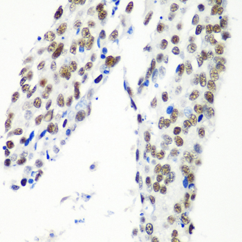 HTATSF1 Polyclonal Antibody (E-AB-62423)