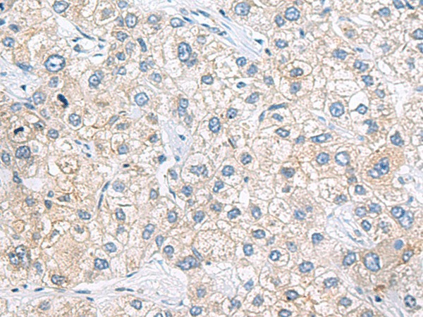 ZNF35 Polyclonal Antibody (E-AB-19555)