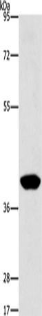 PHYKPL Polyclonal Antibody (E-AB-10756)