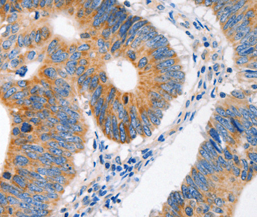 MC1R Polyclonal Antibody (E-AB-15765)