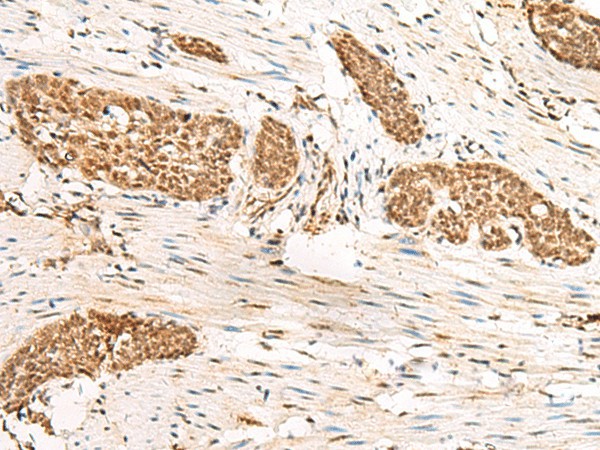 HUS1 Polyclonal Antibody (E-AB-52729)
