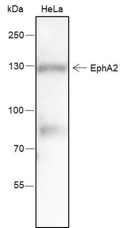 Recombinant EphA2 Monoclonal Antibody (AN301514L)