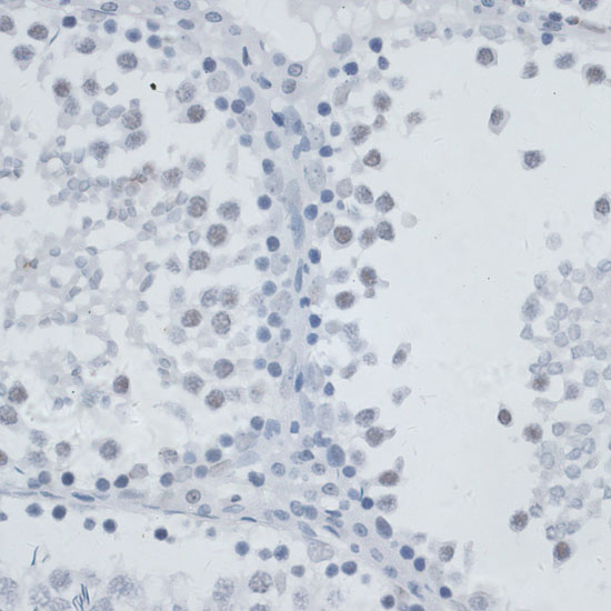 MSH6 Polyclonal Antibody (E-AB-66788)