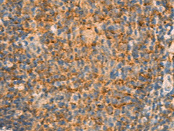 IFITM2 Polyclonal Antibody (E-AB-18890)