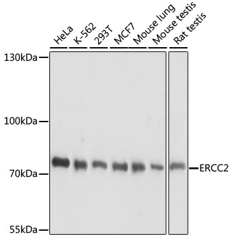 ERCC2 Polyclonal Antibody (E-AB-65037)