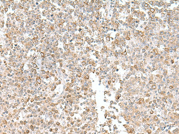 EIF1AY Polyclonal Antibody (E-AB-53042)