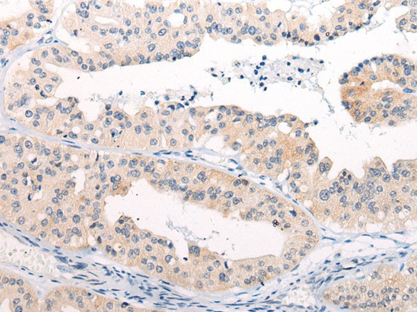 ANAPC15 Polyclonal Antibody (E-AB-17741)