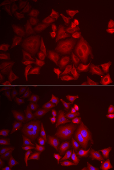 XCL1 Polyclonal Antibody (E-AB-67754)
