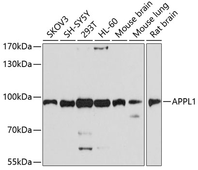 APPL1 Polyclonal Antibody (E-AB-63089)