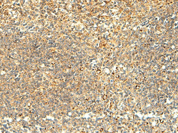 NAPRT Polyclonal Antibody (E-AB-52878)