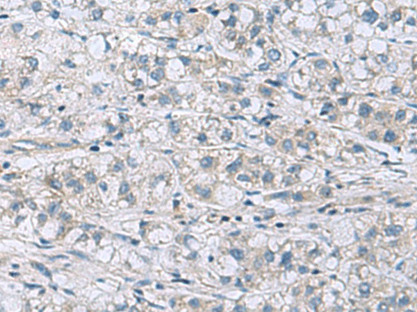 ITGB1BP1 Polyclonal Antibody (E-AB-53077)